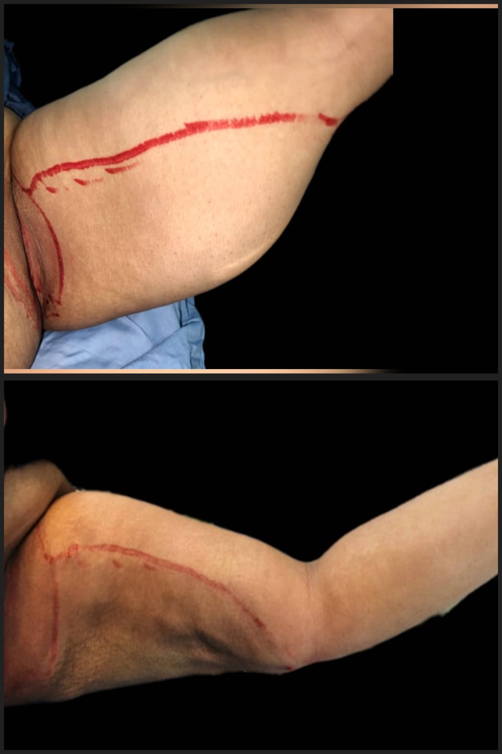 Before & After 48